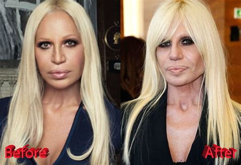 questions to donatella versace|donatella versace before and after surgery.